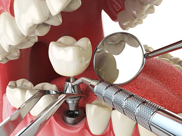 Best Emergency Cosmetic Dentistry (e.g., broken veneers) in Walker, MI